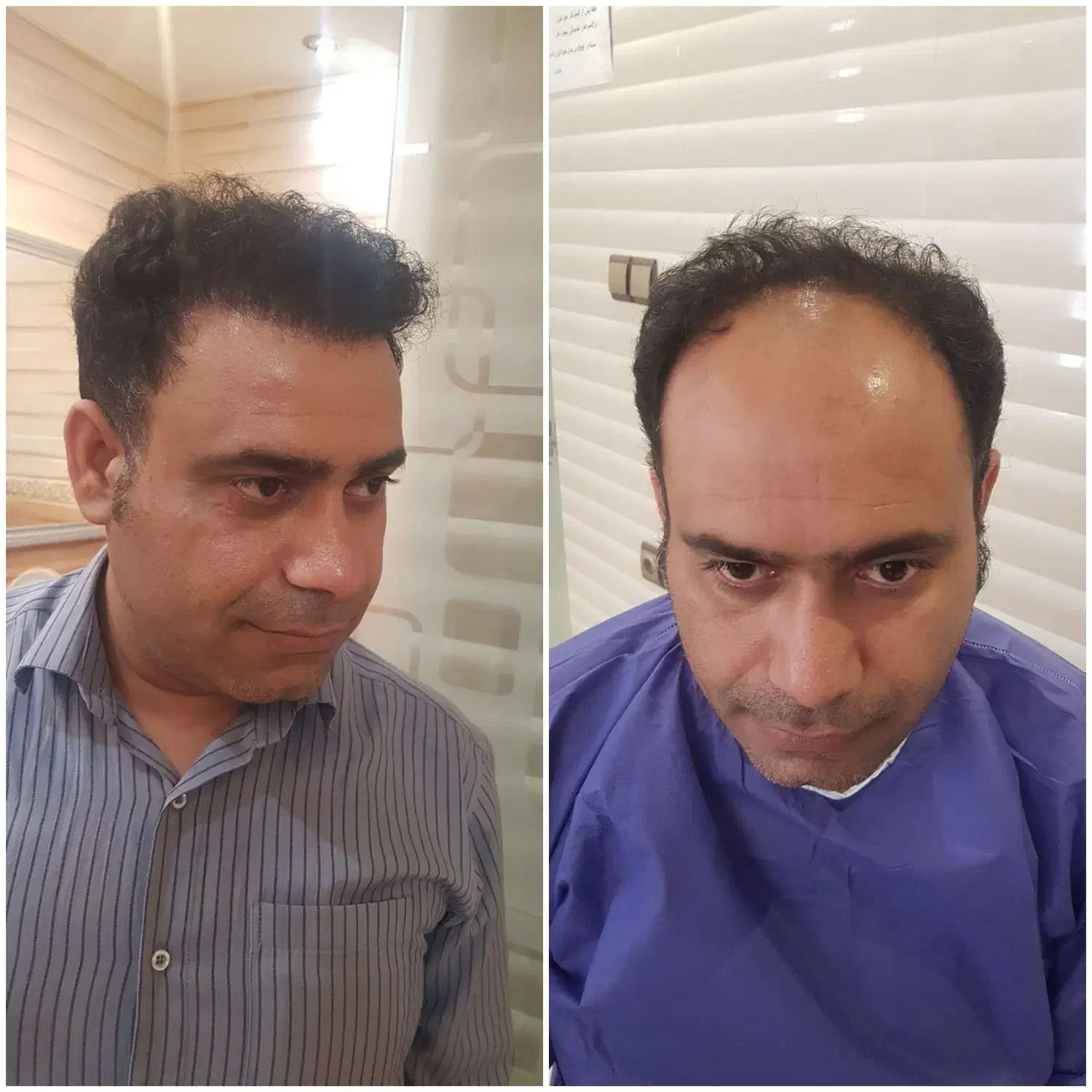 کاشت مو تضمینی واقساط|خدمات آرایشگری و زیبایی|اصفهان, محمودیه|دیوار