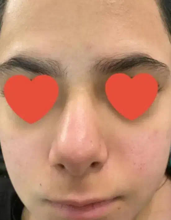 ورکشاپ تخصصی پوست (پاکسازی)|خدمات آموزشی|سیرجان, |دیوار