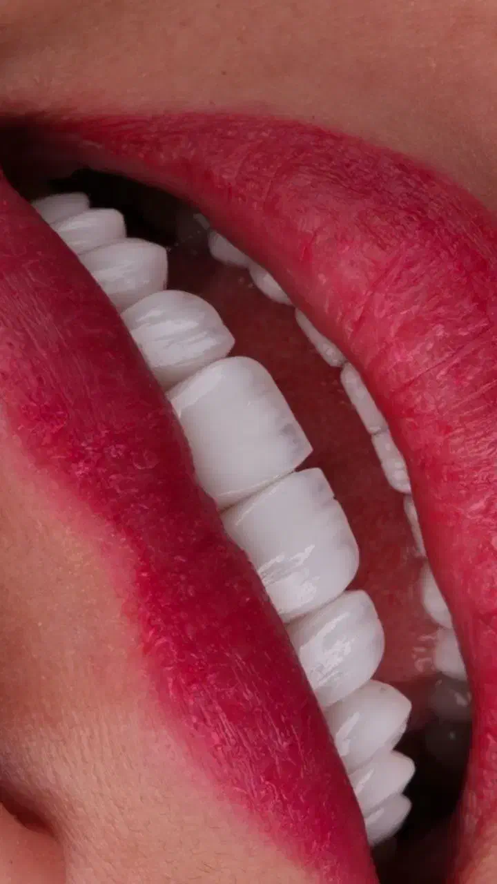 دندان پزشکی ایمپلنت روکش ارتودنسی اقساطی|خدمات آرایشگری و زیبایی|مراغه, |دیوار