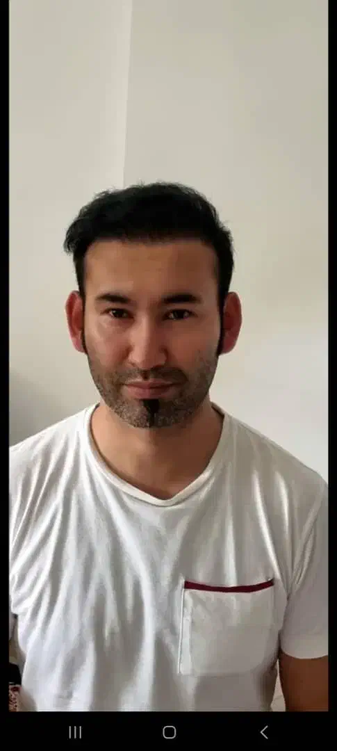 کلینیک کاشت مو|خدمات آرایشگری و زیبایی|مریوان, |دیوار