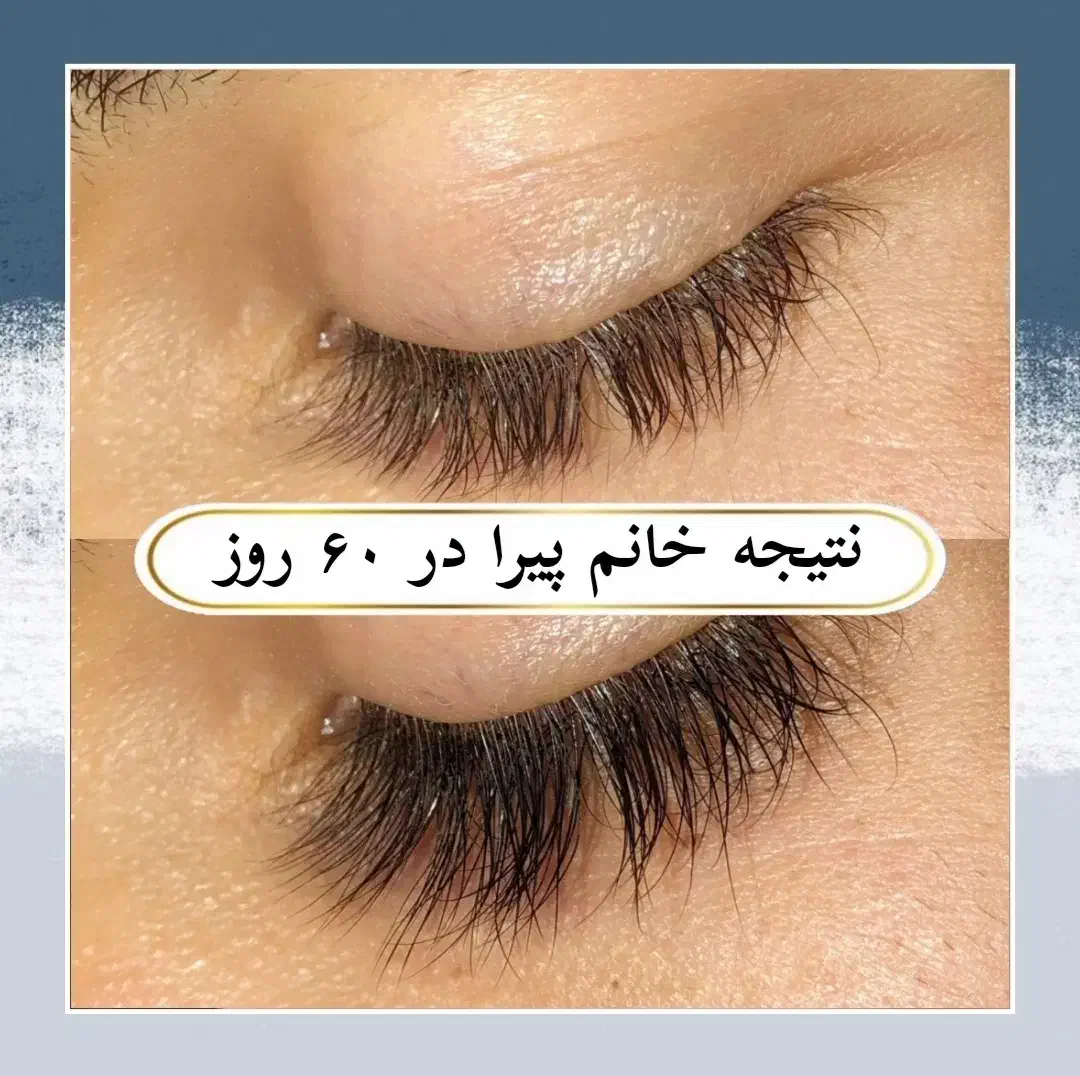 مژه ها و ابروهات رو تقویت کن|خدمات آرایشگری و زیبایی|مشهد, زمرد|دیوار