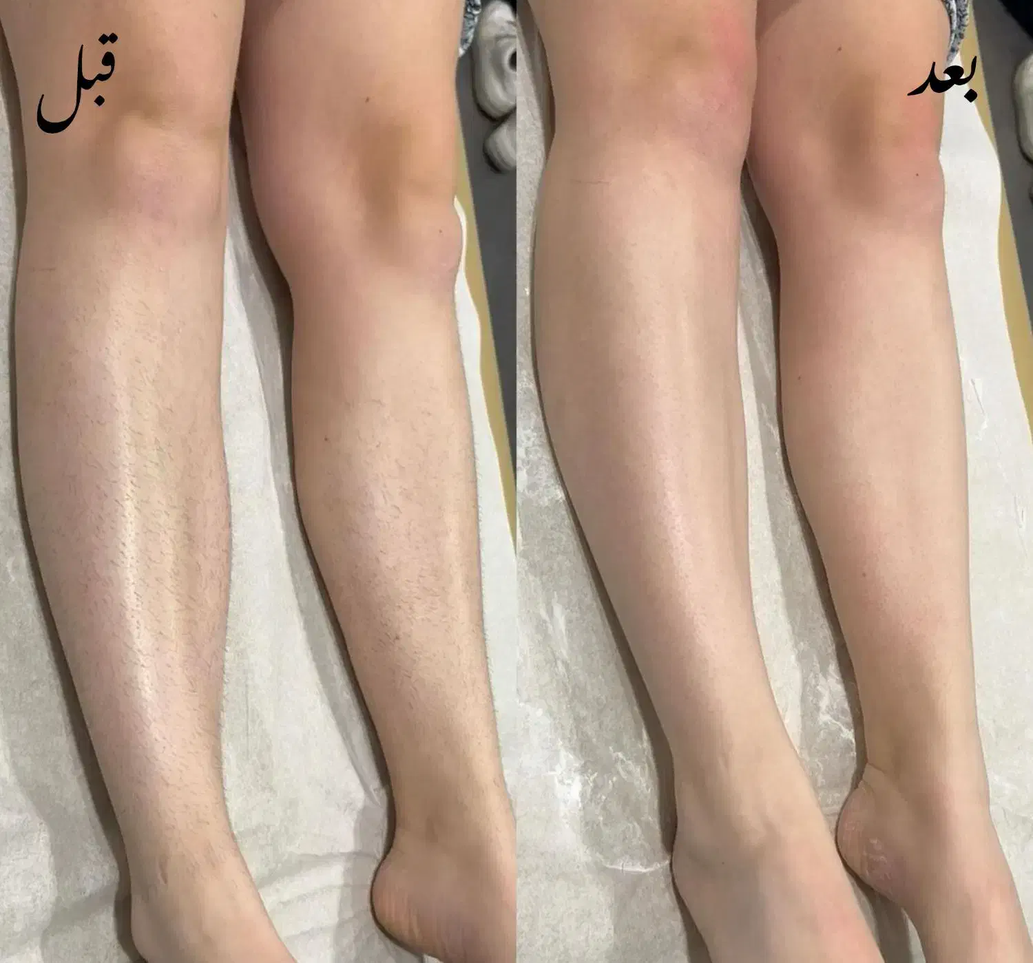 اپیلاسیون و اموزش با مدرک فنی حرفه ای|خدمات آرایشگری و زیبایی|مشهد, گلشور|دیوار