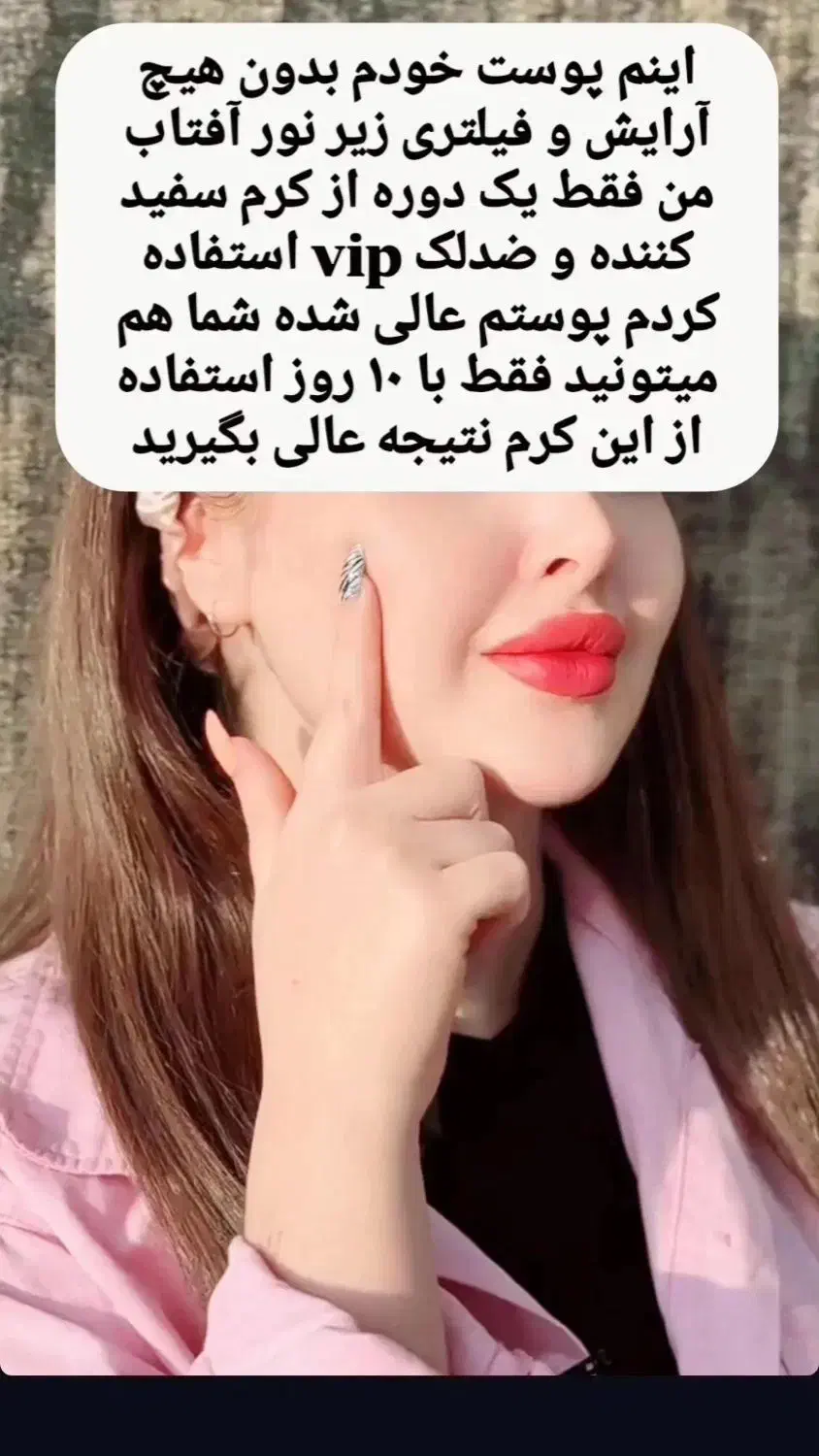 کرم سفید کننده ضدلک وضدجوش اصل سورو|آرایشی، بهداشتی، درمانی|بندرعباس, |دیوار