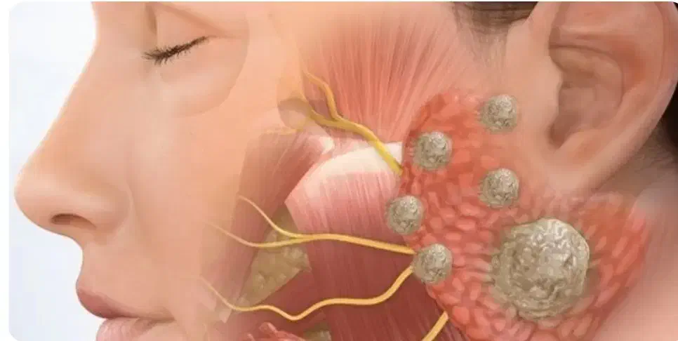 منیر ( قابل توجه بیماران منیر )|آرایشی، بهداشتی، درمانی|شیراز, لشکری|دیوار