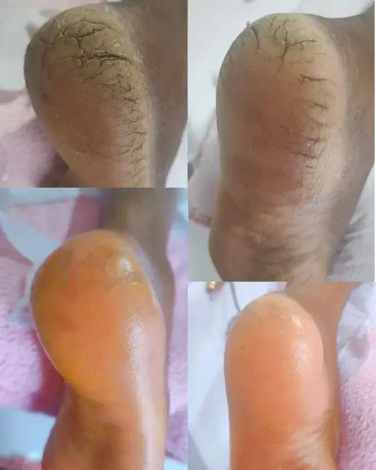 کفسابی پدیکور و رفع تیرگی تخفیف ب مدت ۲ روز|خدمات آرایشگری و زیبایی|فولادشهر, B2|دیوار