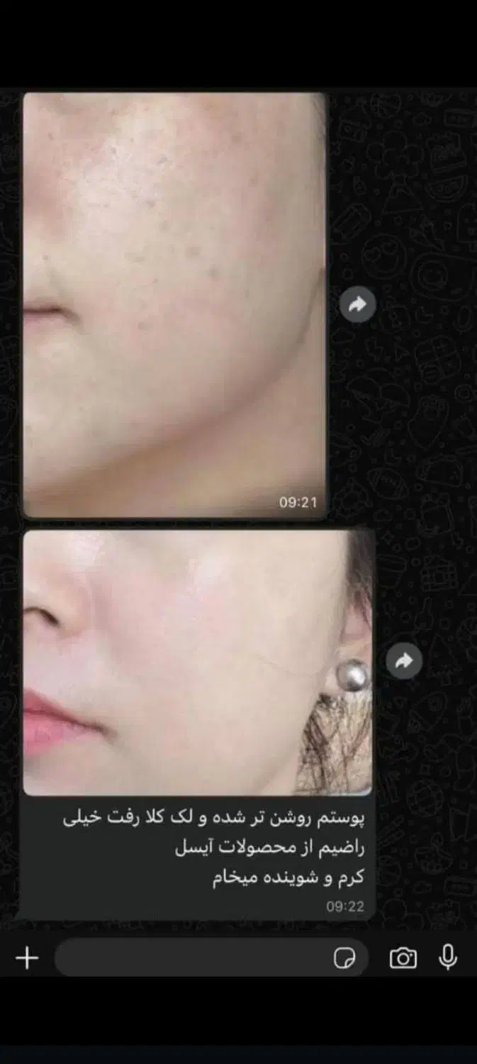 کرم شب آیسل پلاس|آرایشی، بهداشتی، درمانی|ایرانشهر, |دیوار