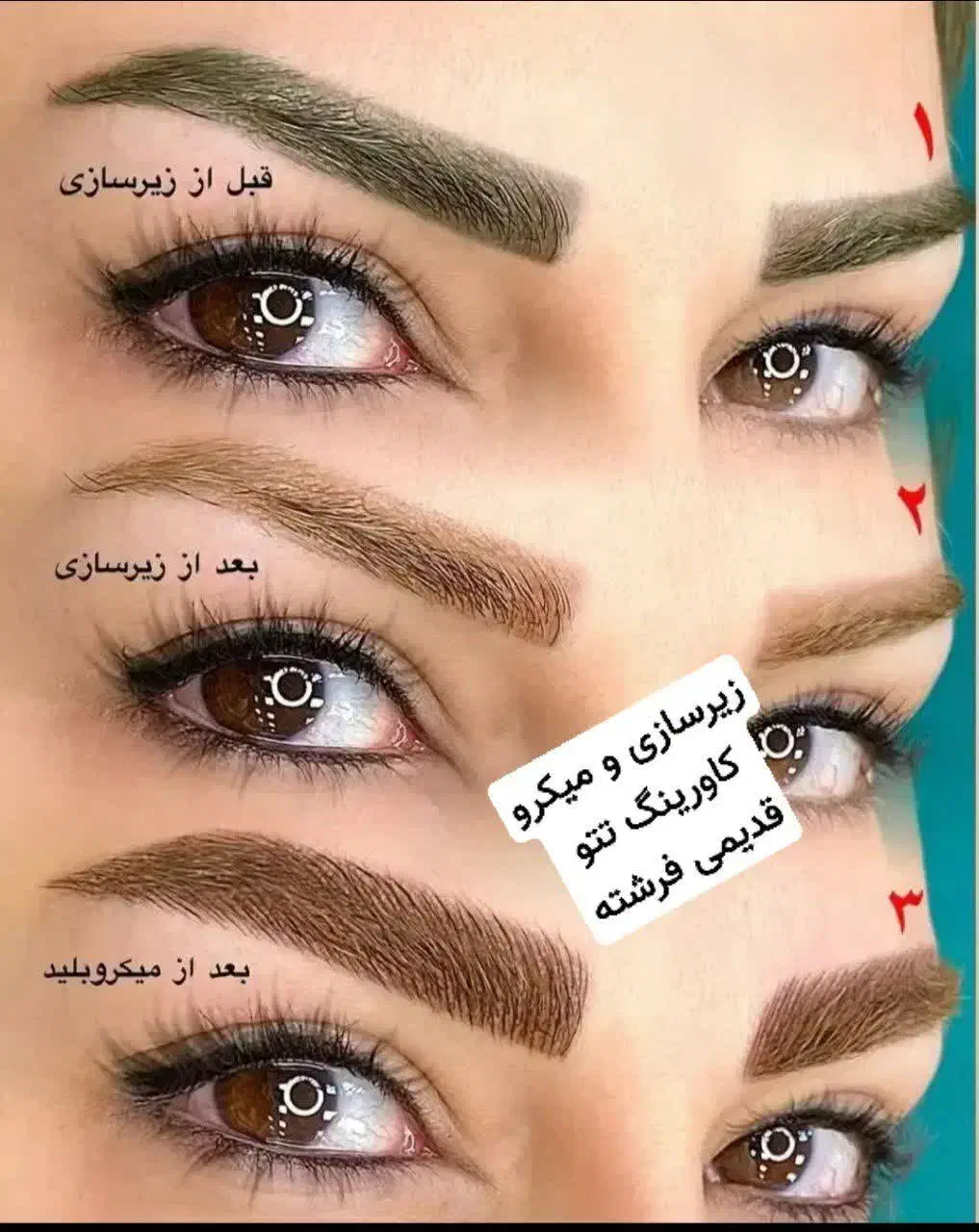 ریمو تتو قدیمی زیرسازی واصلاح میکروکاورینگ|خدمات آرایشگری و زیبایی|اصفهان, خواجه عمید|دیوار