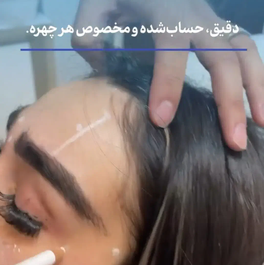 جشنواره بوتاکس|خدمات آرایشگری و زیبایی|اردبیل, |دیوار