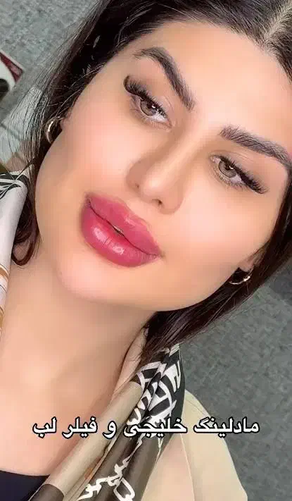 میکروبلیدینگ فیلرو بوتاکس شیدینگ تخفیف یلدایی|خدمات آرایشگری و زیبایی|بیرجند, |دیوار