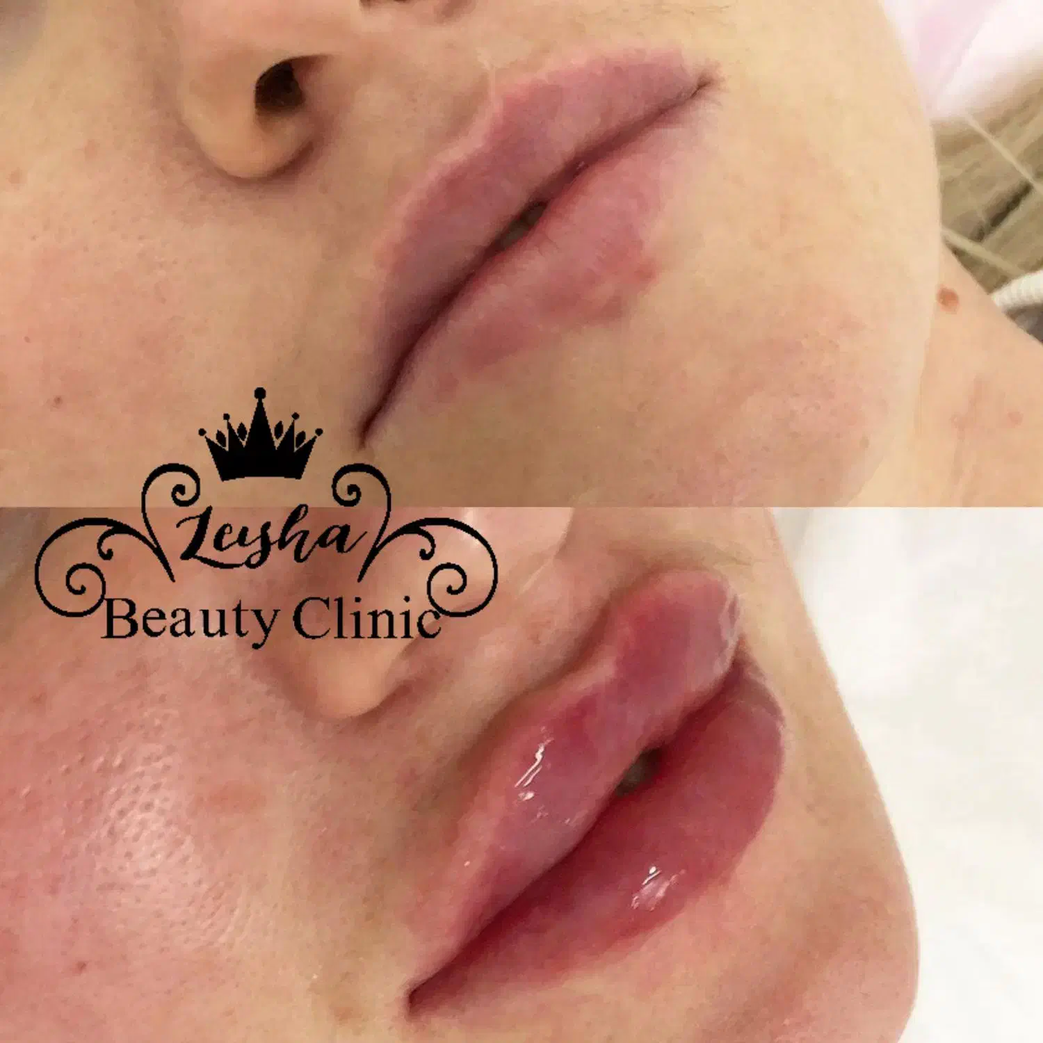 پزشک متخصص زیبایی آماده همکاری با مطبها،کلینیکها.|خدمات آرایشگری و زیبایی|تهران, الهیه|دیوار