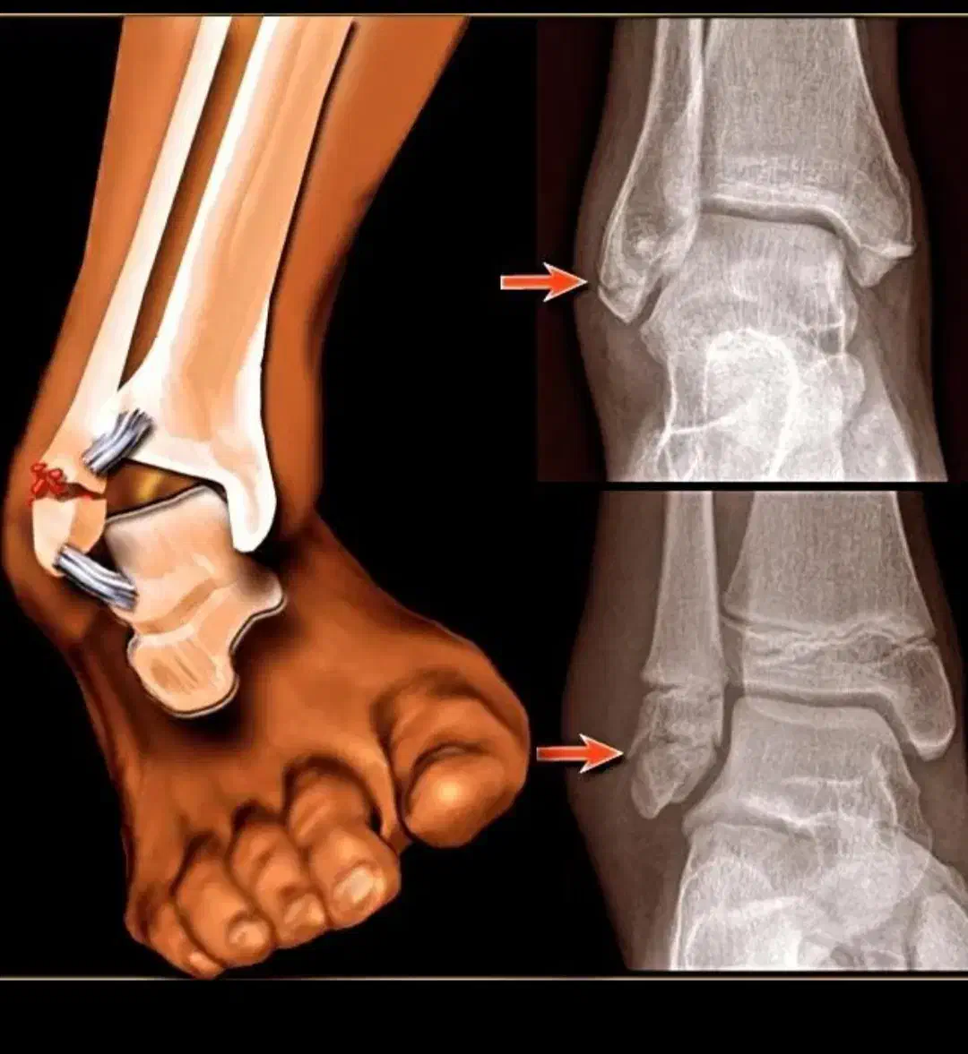 دررفتگی مهره های دیسک|خدمات پیشه و مهارت|نسیم‌شهر, |دیوار