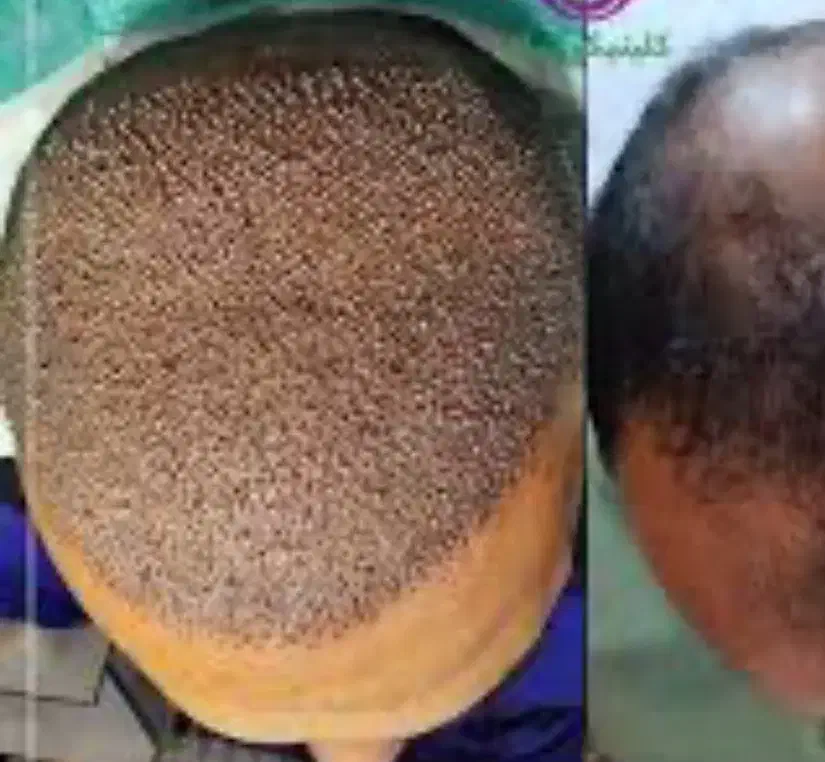 استخدام|استخدام درمانی، زیبایی، بهداشتی|تهران, ونک|دیوار