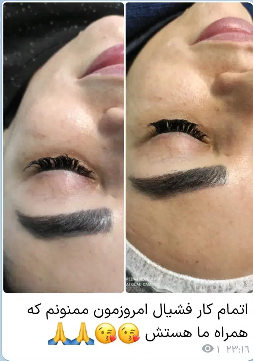 فیشال روتین پوستی رایگان|خدمات آرایشگری و زیبایی|قم, بکایی|دیوار