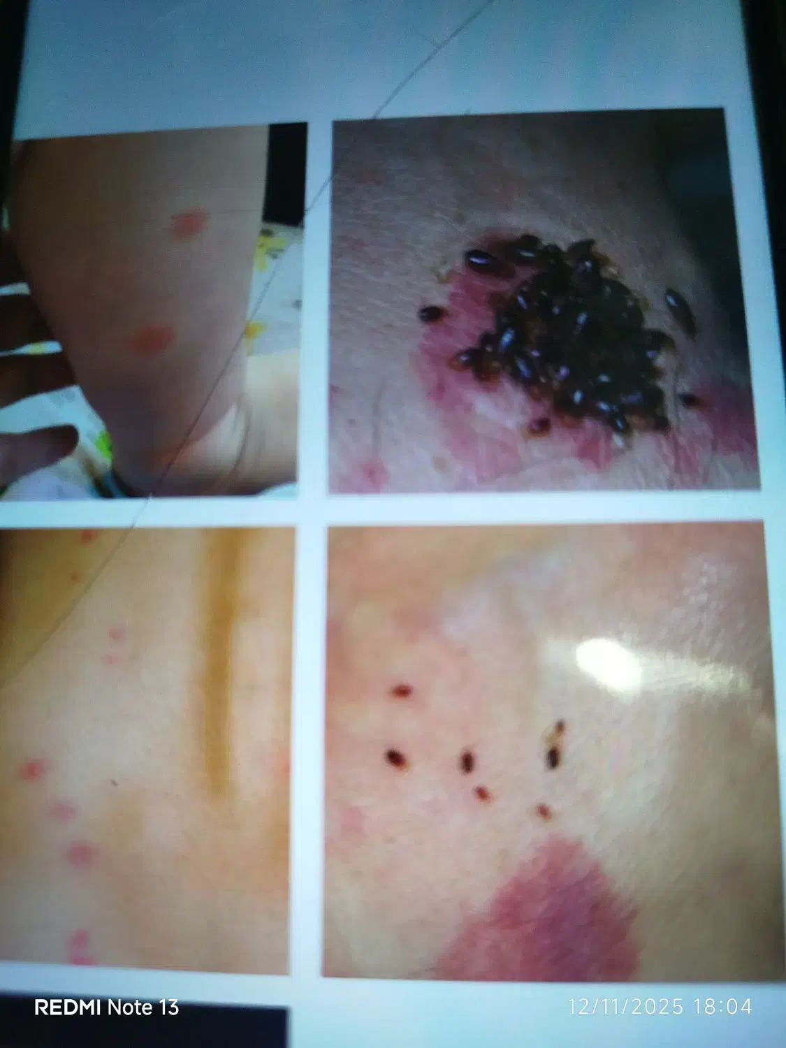 سم پاشی منازل و کارگاه های صنعتی و دام و طیور|خدمات نظافت|محمدیه-قزوین, |دیوار