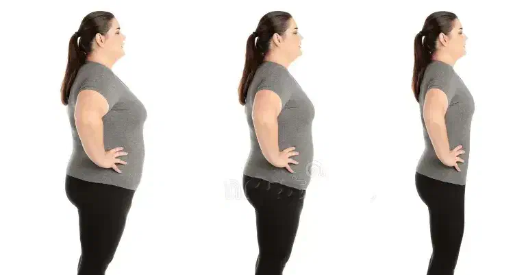 لاغری با دستگاه های غیر تهاجمی بدون عوارض|خدمات آرایشگری و زیبایی|گرگان, |دیوار