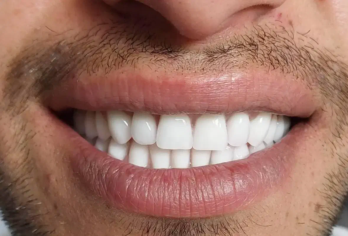 دندانپزشکی اقساطی با وام قرض الحسنه|خدمات آرایشگری و زیبایی|اصفهان, لاله|دیوار