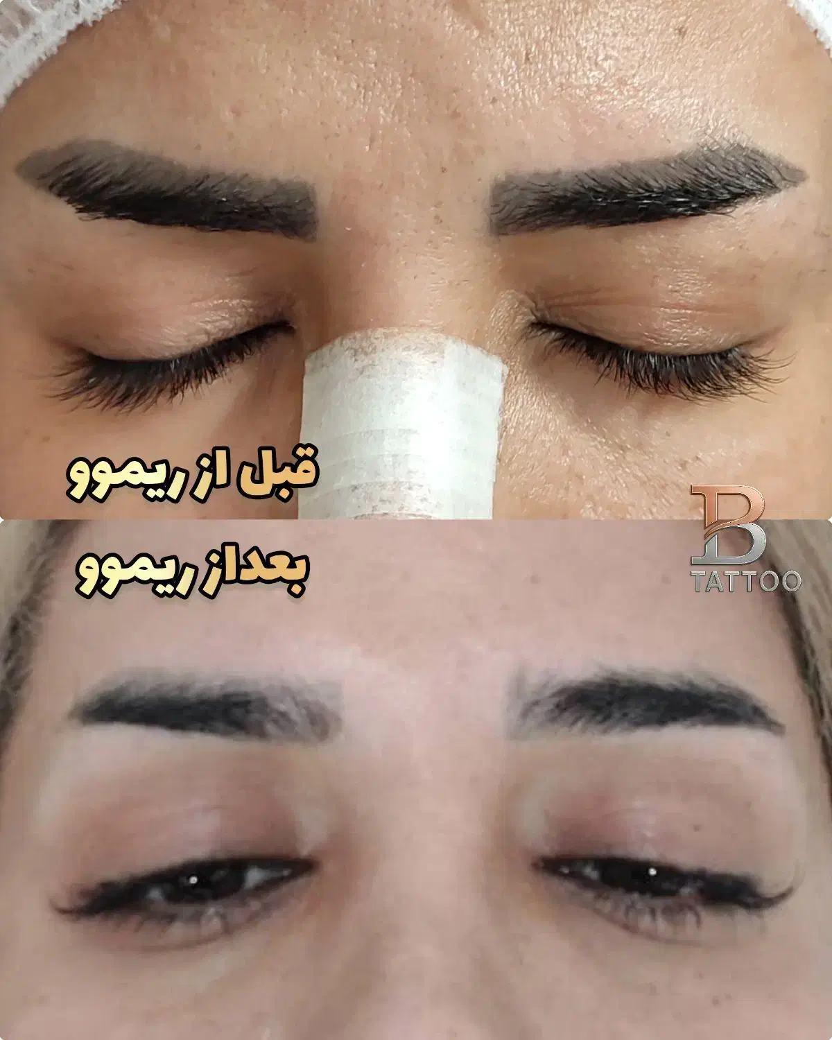 پاک کردن تتوابرو،خطچشم،خطلب(ریموو)|خدمات آرایشگری و زیبایی|شاهین‌شهر, شهرک میلاد|دیوار