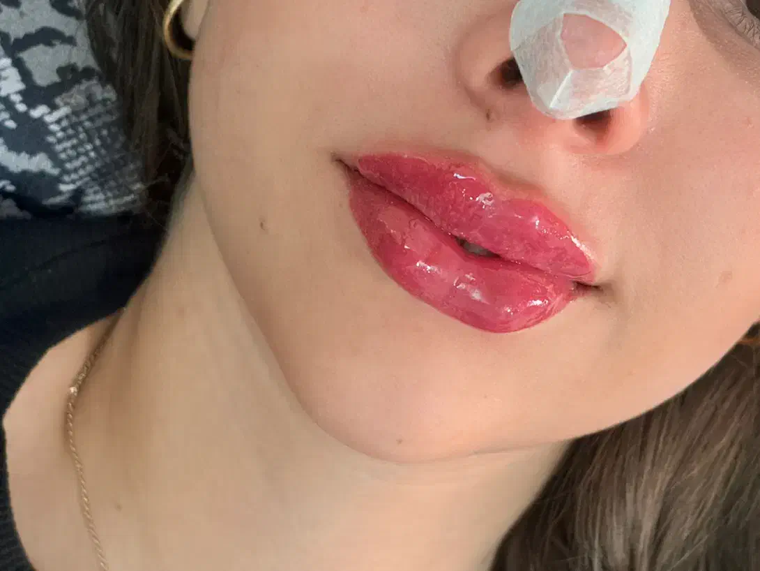 تخفیف ویژه ژل و بوتاکس|خدمات آرایشگری و زیبایی|گنبد کاووس, |دیوار