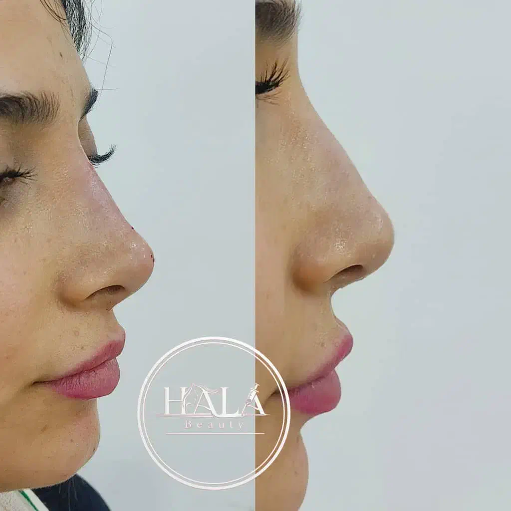 خدمات زیبایی صورت|خدمات آرایشگری و زیبایی|آبادان, |دیوار