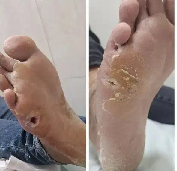 بهبودودرمان قندخون بصورت گیاهی|آرایشی، بهداشتی، درمانی|اهواز, شریعتی جنوبی|دیوار