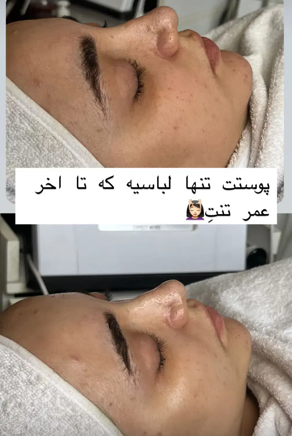 فیشال پاکسازی تخصصی پوست یون تراپی پاکسازی کبد|خدمات آرایشگری و زیبایی|مشهد, آزادشهر|دیوار