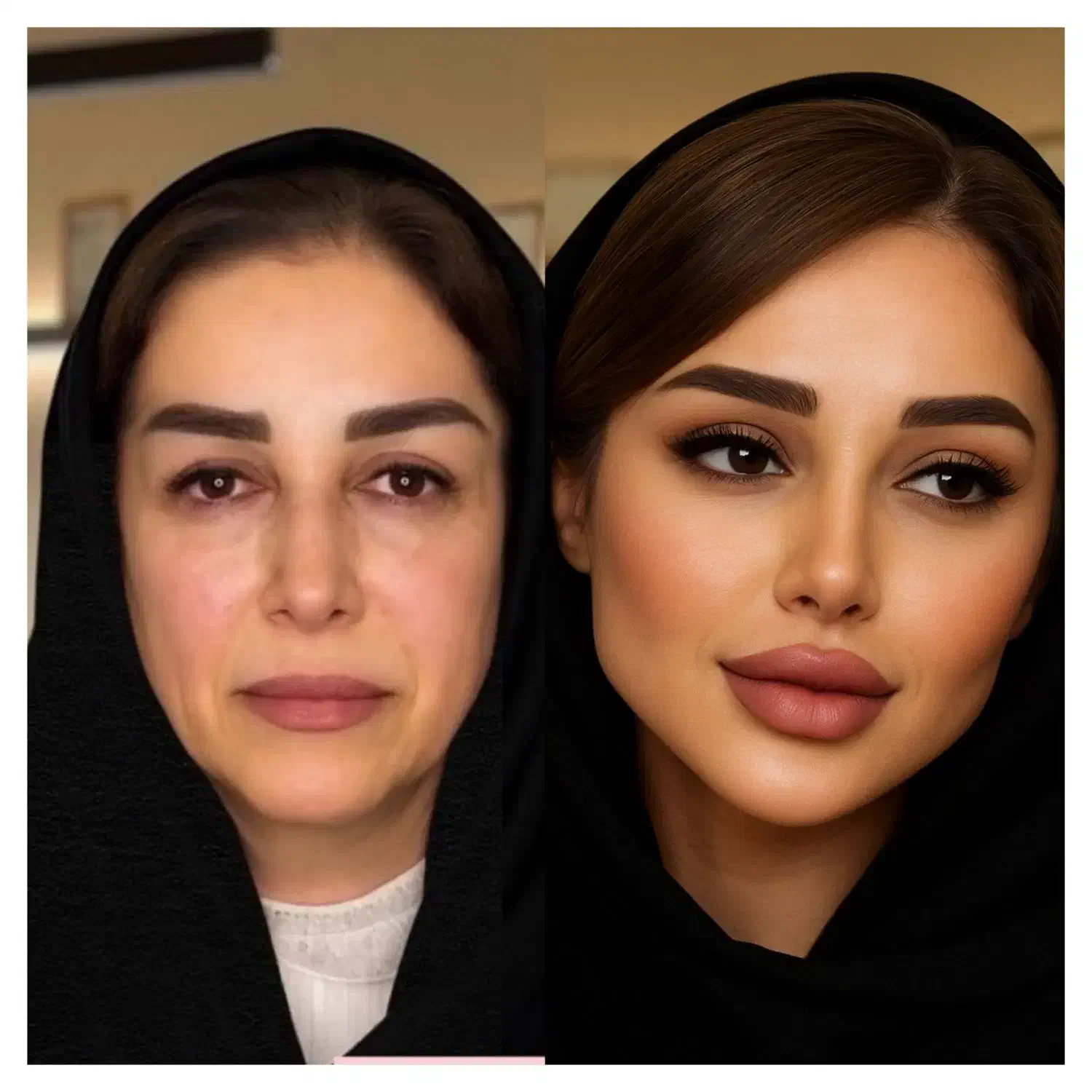 کلینیک تخصصی پوست نخ هایفو لیزر آموزش ژل بوتاکس|خدمات آرایشگری و زیبایی|تهران, زعفرانیه|دیوار