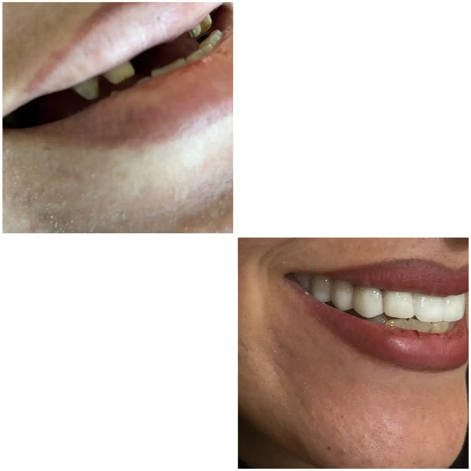 کامپوزیت خرم اباد|خدمات آرایشگری و زیبایی|بروجرد, |دیوار