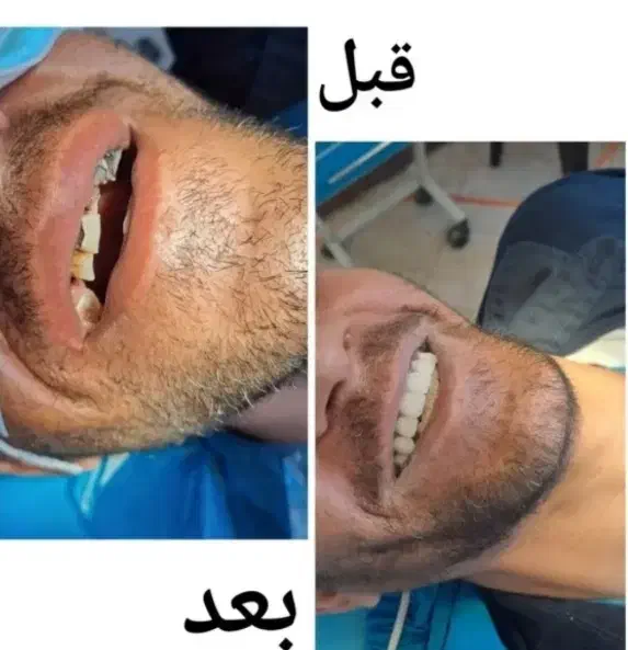 خدمات دندان پزشکی|خدمات آرایشگری و زیبایی|بروجرد, |دیوار