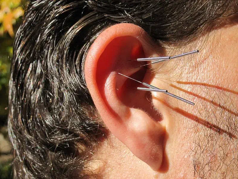 آموزش طب سوزنی و طب فشاری با گواهینامه معتبر|خدمات آموزشی|تهران, فردوسی|دیوار