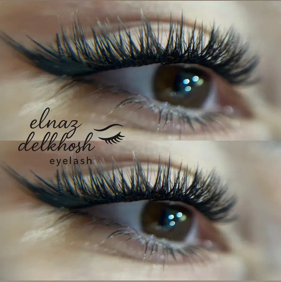 آموزشو خدمات کاشت هیدن|خدمات آرایشگری و زیبایی|رشت, انصاری|دیوار