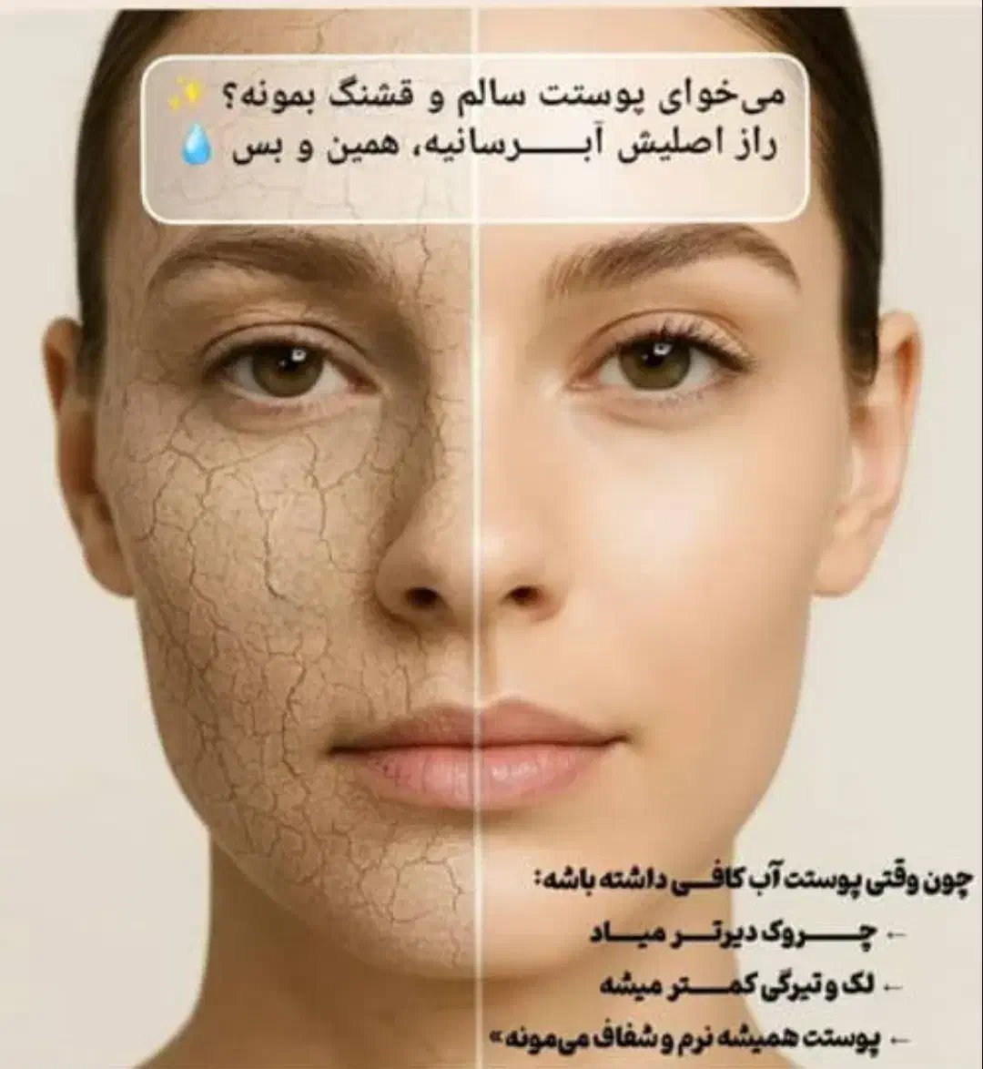 فیشال تخصصی صورت ویژه بانوان|خدمات آرایشگری و زیبایی|شیراز, هفت تنان|دیوار