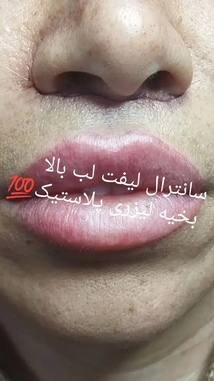 تخفیف ویژه خدمات زیبایی|خدمات آرایشگری و زیبایی|کوهدشت, |دیوار