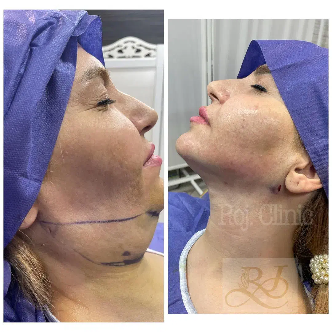 تخفیف مشاوره خدمات زیبایی وجراحی صورت  بدن|خدمات آرایشگری و زیبایی|تهران, میدان ولیعصر|دیوار