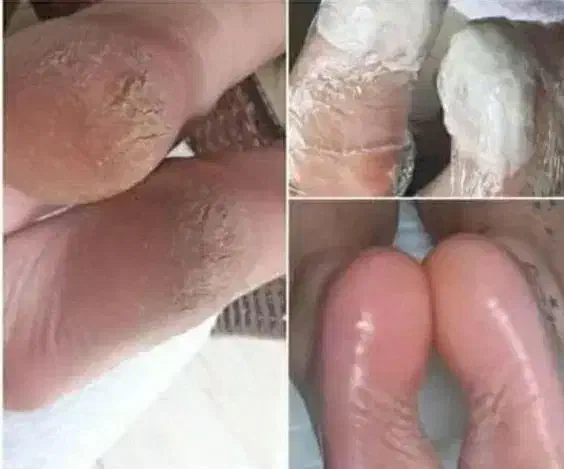 آموزش پدیکور|خدمات آموزشی|بروجرد, |دیوار