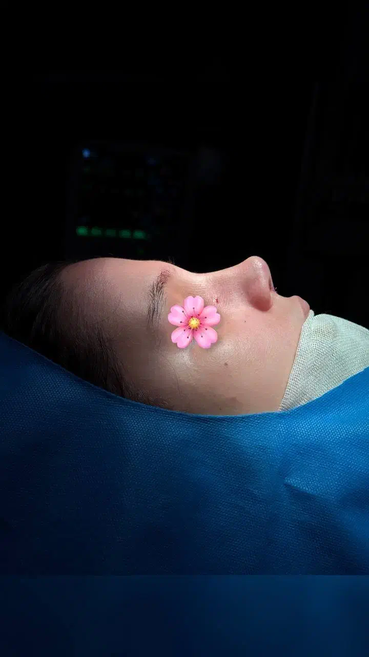 عمل بینی فقط با ۲۵ تومن تا پایان مهر ماه در تهران|خدمات آرایشگری و زیبایی|قم, بکایی|دیوار