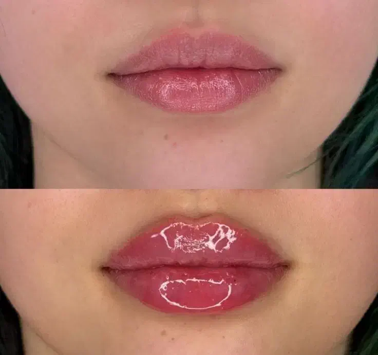 مطب پوست مو تزریق بوتاکس فیلر مزوتراپی هایفو|خدمات آرایشگری و زیبایی|محمدشهر, محمدشهر|دیوار