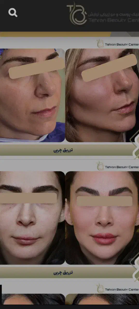زیبایی/کاشت مو/رفع غبغب/تزریق ژل/ کلینیک در تهران|خدمات آرایشگری و زیبایی|ارومیه, |دیوار
