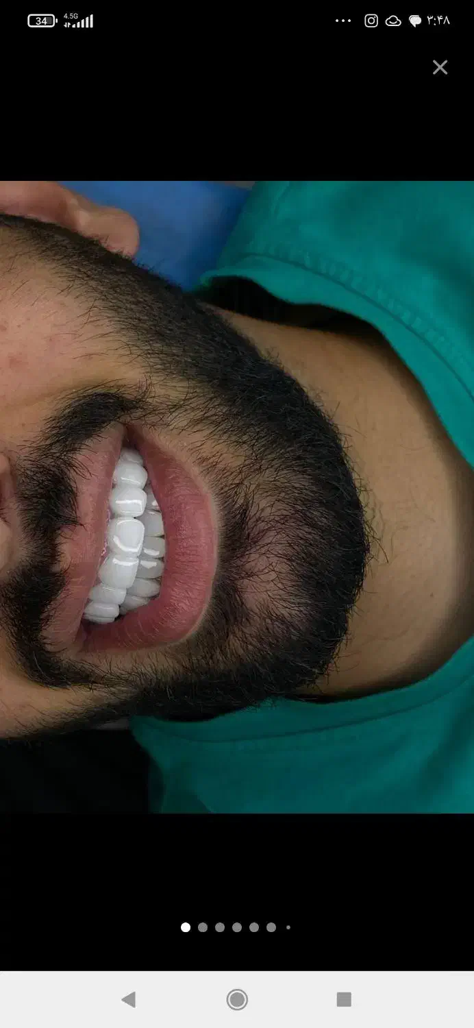 ویزیتور دندان پزشکی|استخدام درمانی، زیبایی، بهداشتی|تبریز, |دیوار