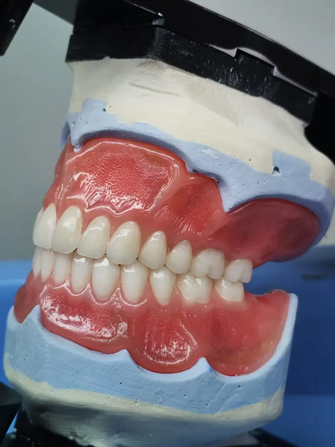 دندان مصنوعی ایتالیایی|آرایشی، بهداشتی، درمانی|چناران, |دیوار