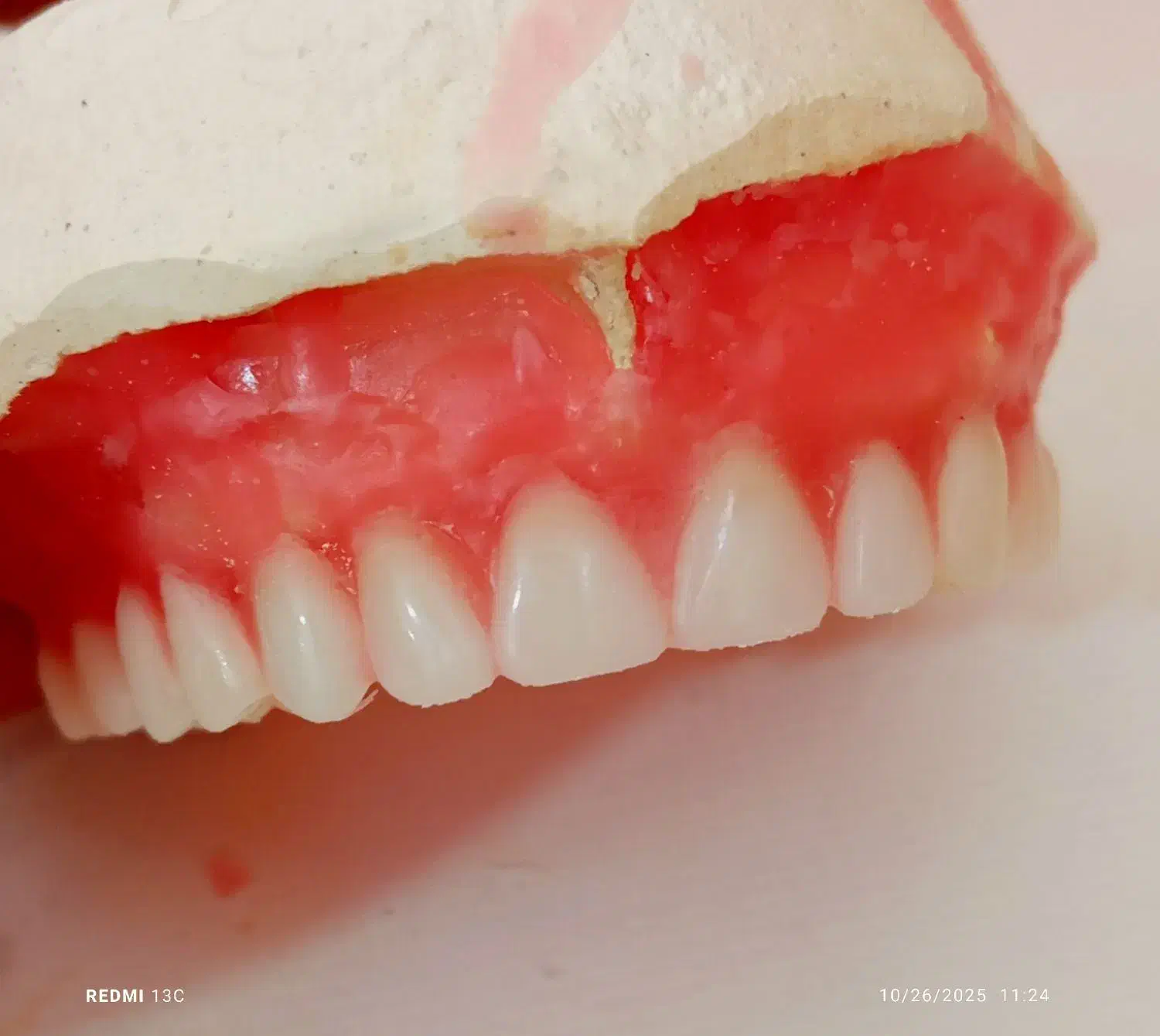 ساخت دندان مصنوعی|پزشکی|سنندج, |دیوار