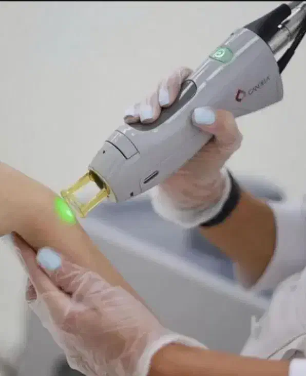 دستگاه لیزر الکساندرایت کندلا 2025آمریکا|خدمات آرایشگری و زیبایی|دوگنبدان, |دیوار