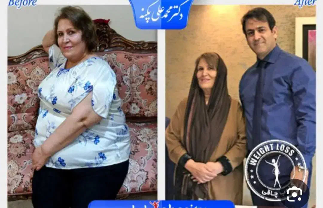 درمان قطعی چاقی واضافه وزن درکمترین زمان وزن کم کن|خوردنی و آشامیدنی|مینودشت, |دیوار