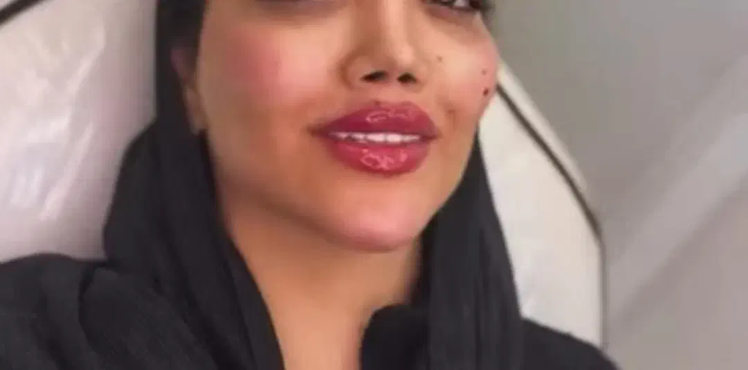 نیازمند مدل تزریق ژل|خدمات آرایشگری و زیبایی|ارومیه, |دیوار