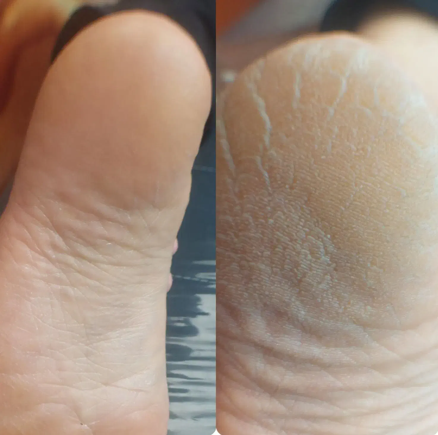 کاشت ناخن ،،کفسابی وپدیکور،موخوره گیری|خدمات آرایشگری و زیبایی|ساوه, |دیوار