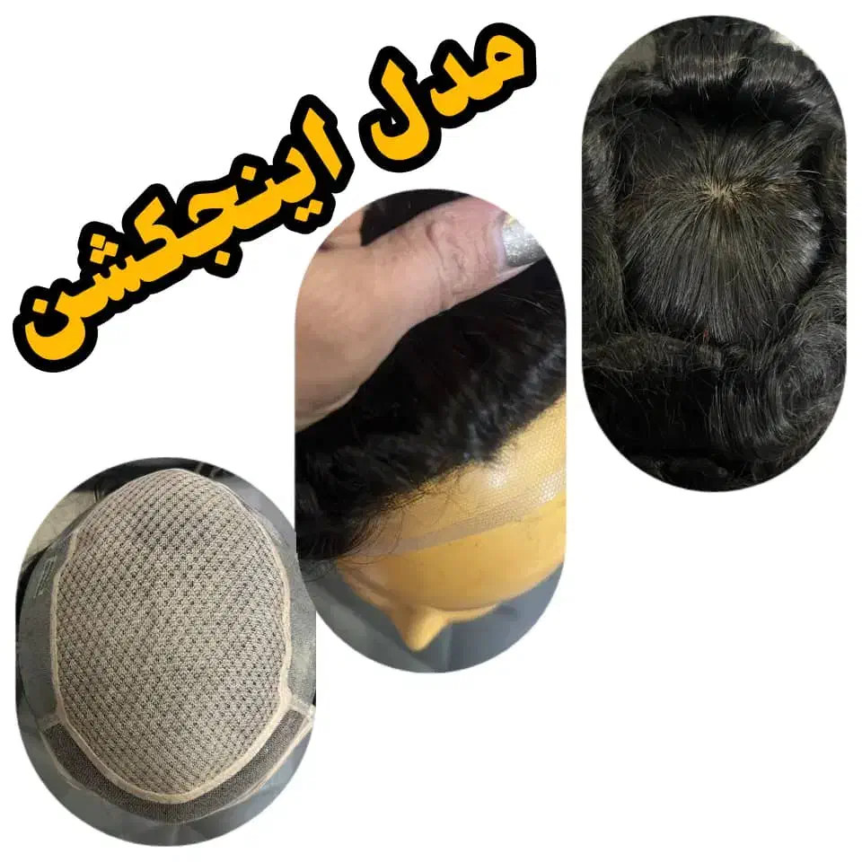 تعویض چسب پروتز مو در محل|خدمات آرایشگری و زیبایی|تهران, شکوفه|دیوار