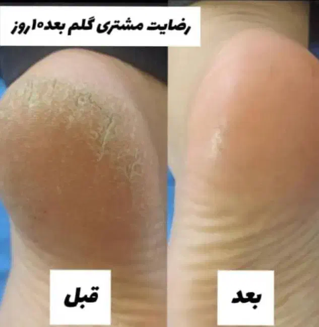 پماد|آرایشی، بهداشتی، درمانی|اهواز, عین ۲|دیوار