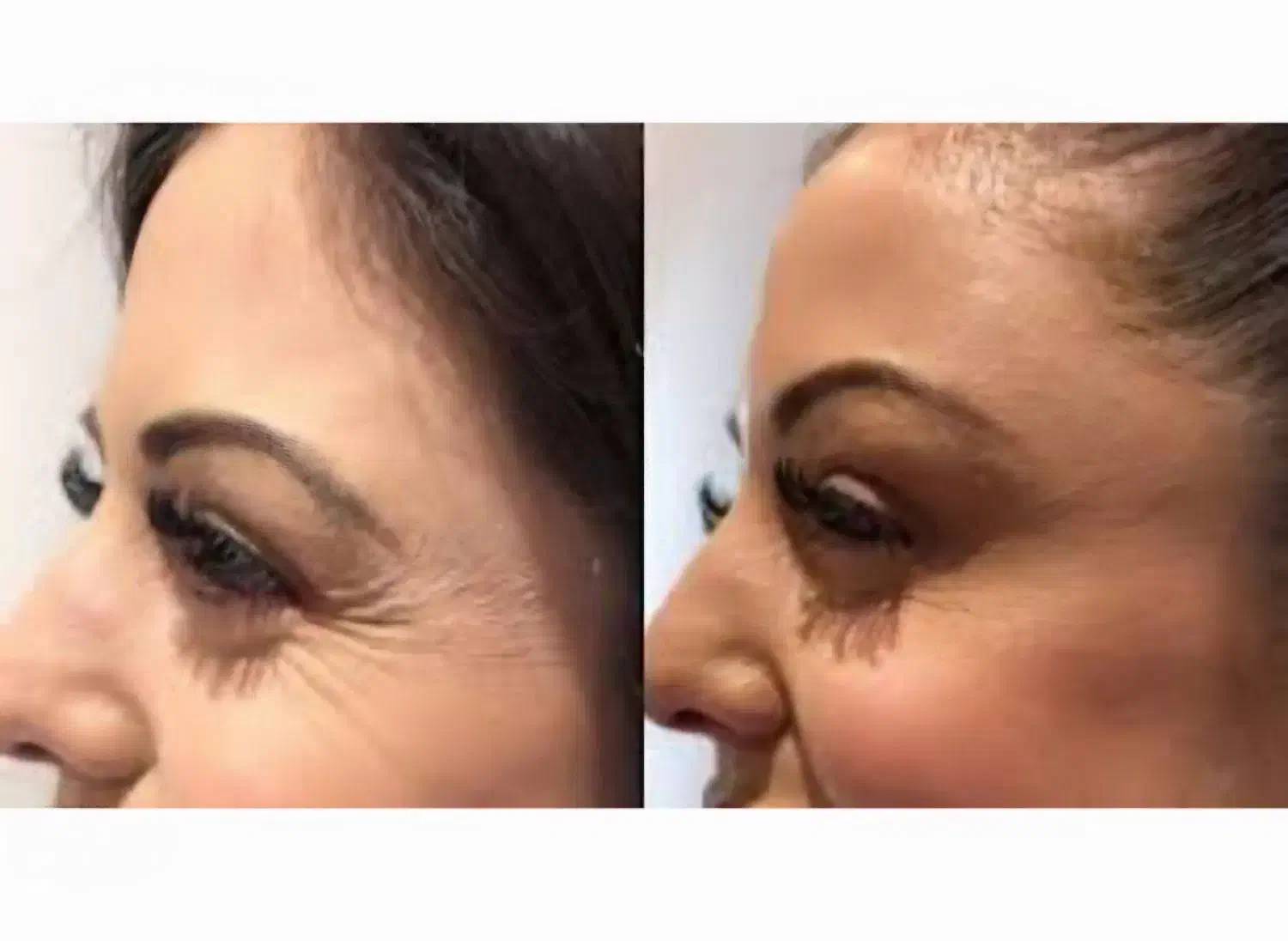 جراحی بینی بدون تامپون با ۲۵ سال سابقه|خدمات آرایشگری و زیبایی|کرج, مهرویلا جنوبی|دیوار