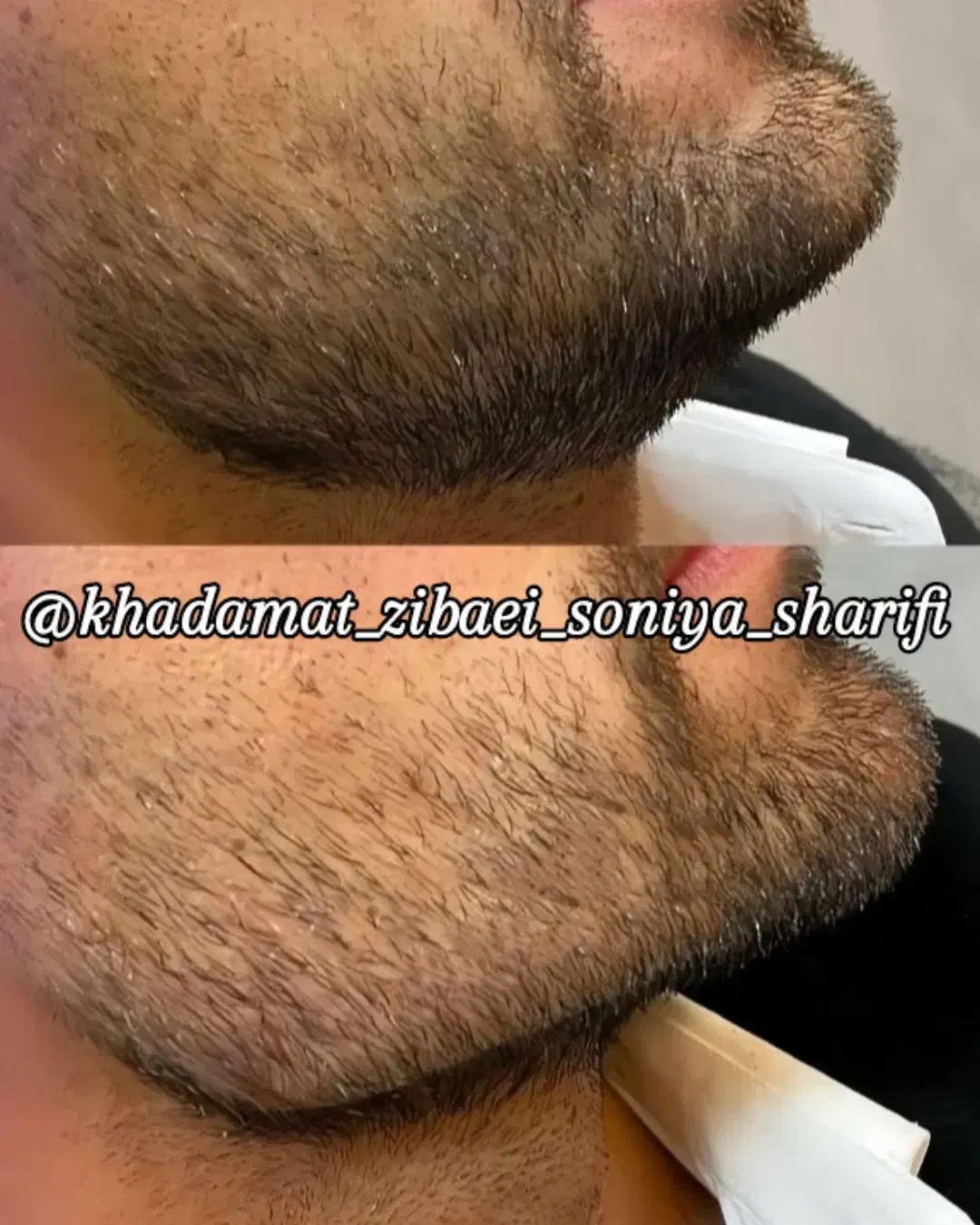 تخفیف ویژه ژل و بوتاکس تا یک هفته|خدمات آرایشگری و زیبایی|اهواز, منبع اب|دیوار