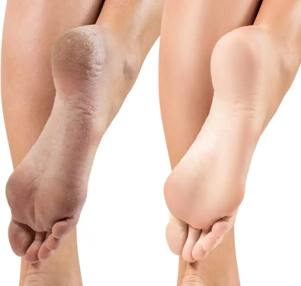 معجزه ای برای پوست شما|آرایشی، بهداشتی، درمانی|اردبیل, |دیوار