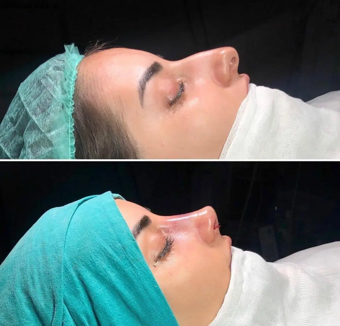 عمل جراحی زیبایی بینی،صورت،پلک،لیپو ابدو|خدمات زیبایی و سلامت|تهران, نازیآباد|دیوار